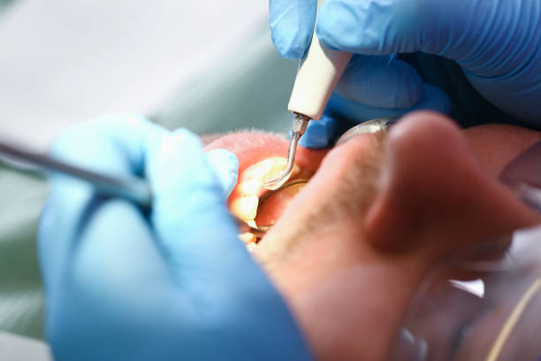 Best Broken Tooth Emergency  in Hancock, MI